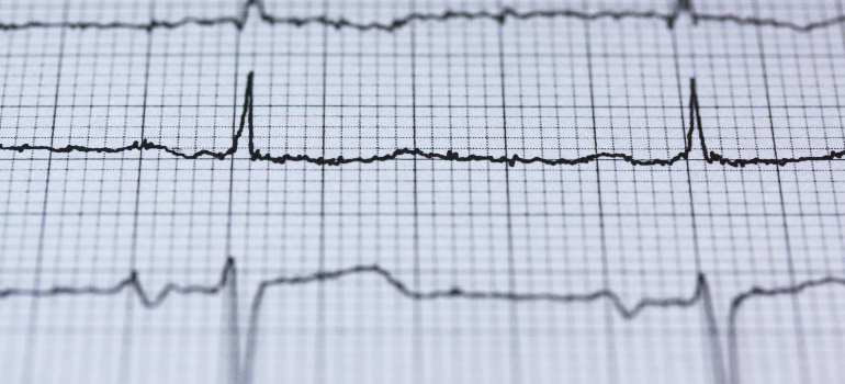 a close-up of an EKG 